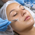 Chemical Peel