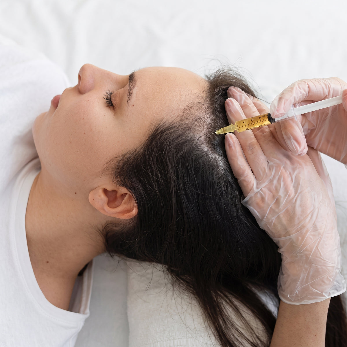 PRP Face Treatment