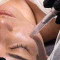 Microneedling