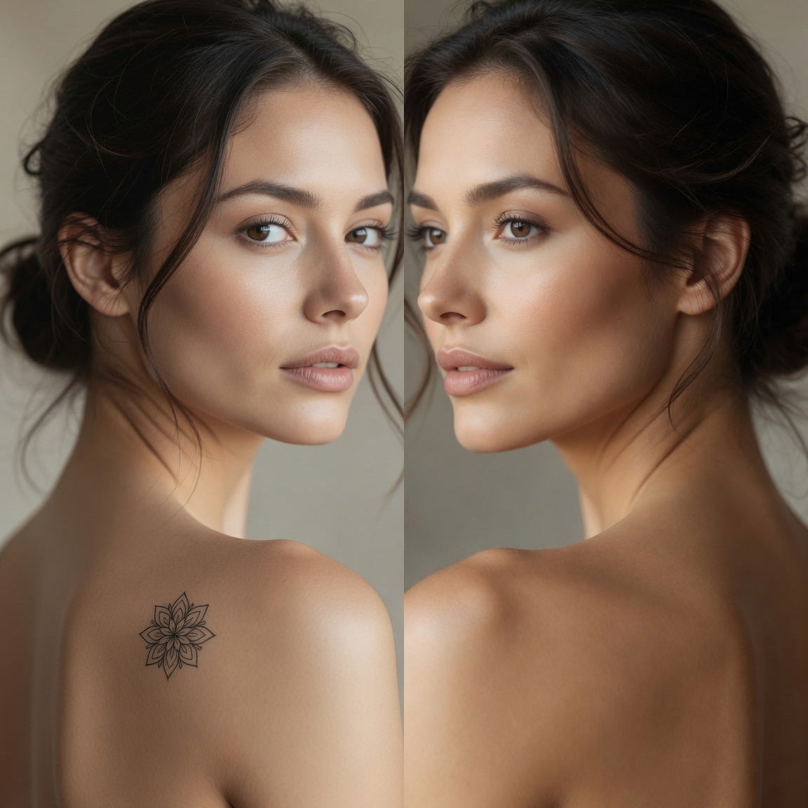Tattoo Removal